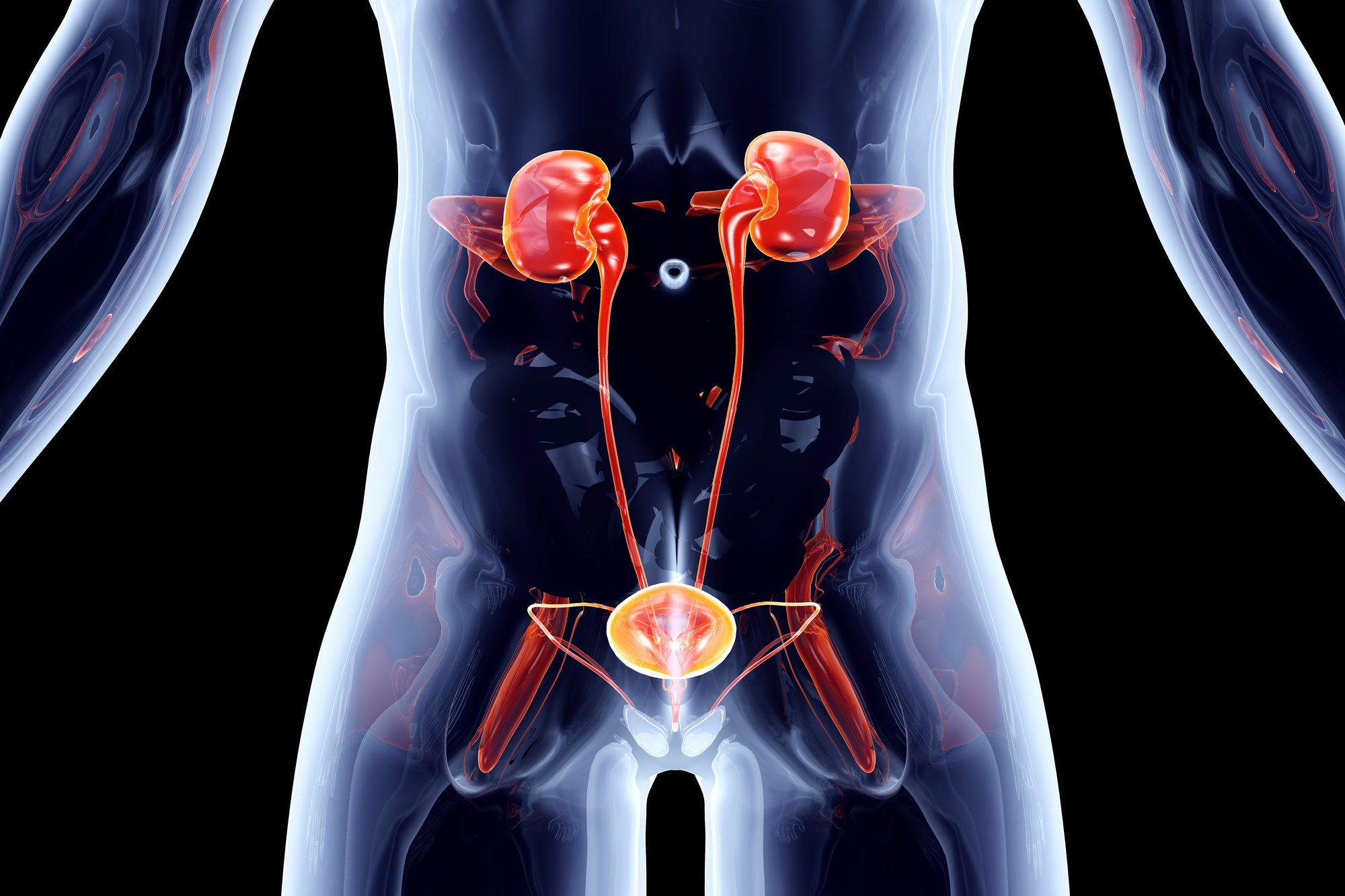 Non-Contrast CT in Urinary Tract Evaluation - Get Your CEU