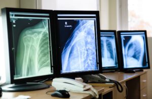 Understanding Digital Radiography and PACS